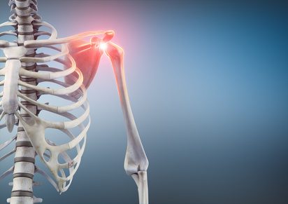 Rotatorentraining Impingement-Syndrom
